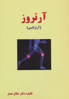 آرتروز (انسان برتر)