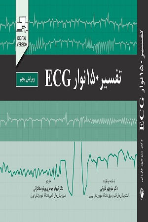 تفسیر 150 نوار ECG (الکتروکاردیوگرام)