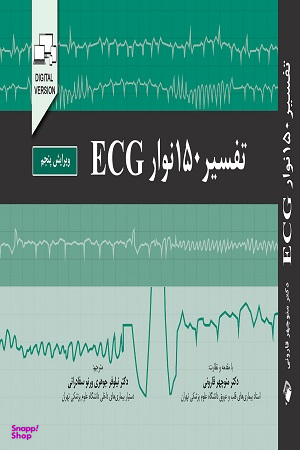 تفسیر 150 نوار ECG (الکتروکاردیوگرام)
