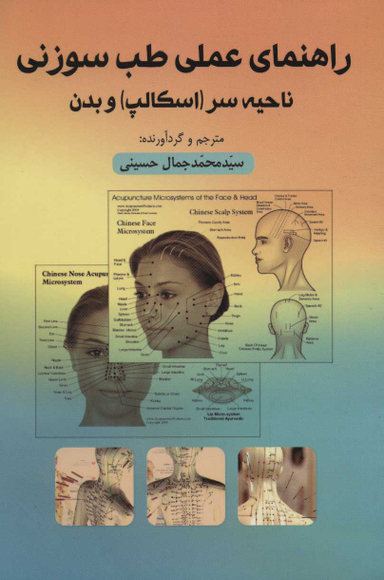 راهنمای عملی طب سوزنی ناحیه سروبدن