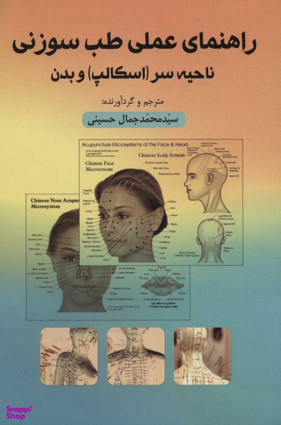راهنمای عملی طب سوزنی ناحیه سروبدن