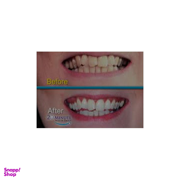 جرم گیر ، لمینت و بلیچینگ دندان وایت اسمایل (White smile) مدل sfz-20