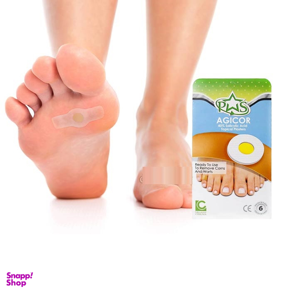 چسب ضد میخچه و زگیل آجیکور (Agicor) مدل 40% Salicylic Acid بسته 6 عددی مجموعه 2 عددی