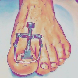 ارتودنسی ناخن