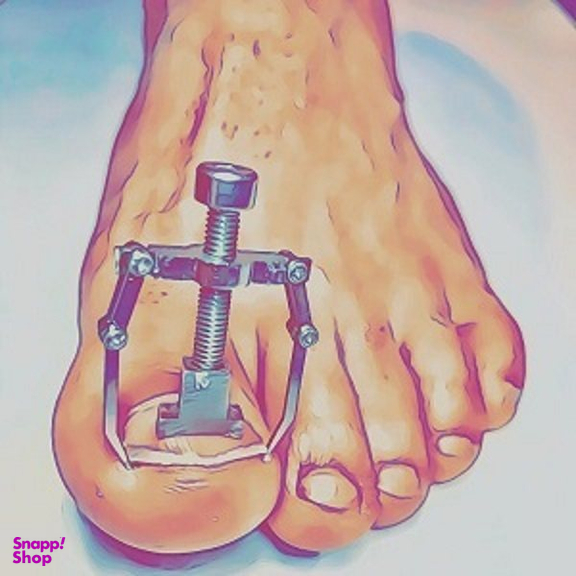 ارتودنسی ناخن