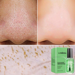 سرم ضد جوش لنبنا مدل BLACKHEAD حجم 17 میلی لیتر