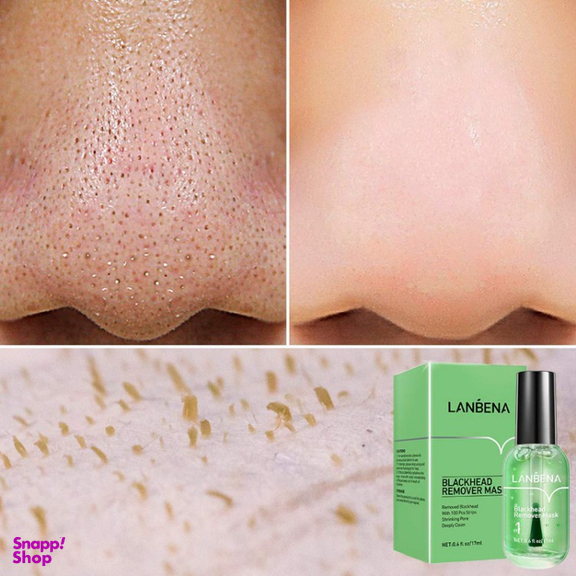 سرم ضد جوش لنبنا مدل BLACKHEAD حجم 17 میلی لیتر