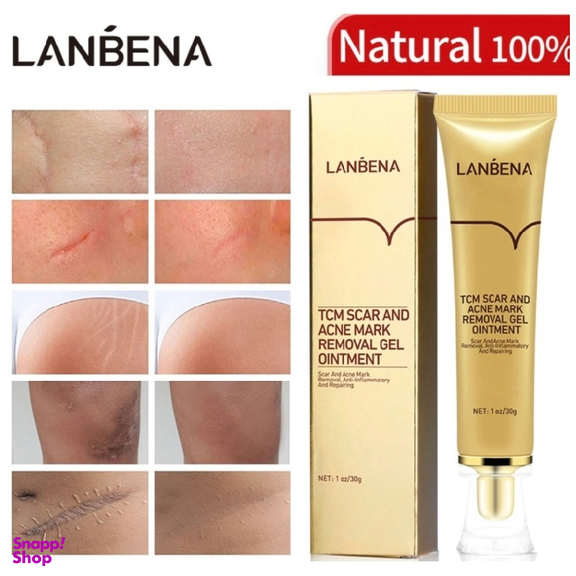 ژل ترمیم کننده اسکار و آکنه لانبنا مدل Tcm حجم 30 میلی لیتر