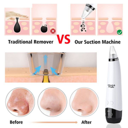 میکرودرم خانگی گلویش استایل مدل MP503