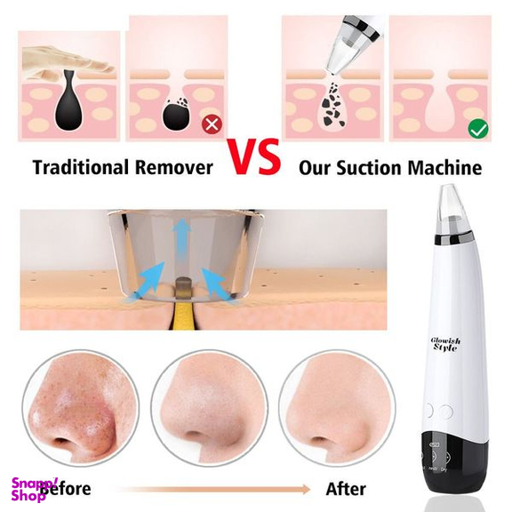 میکرودرم خانگی گلویش استایل مدل MP503