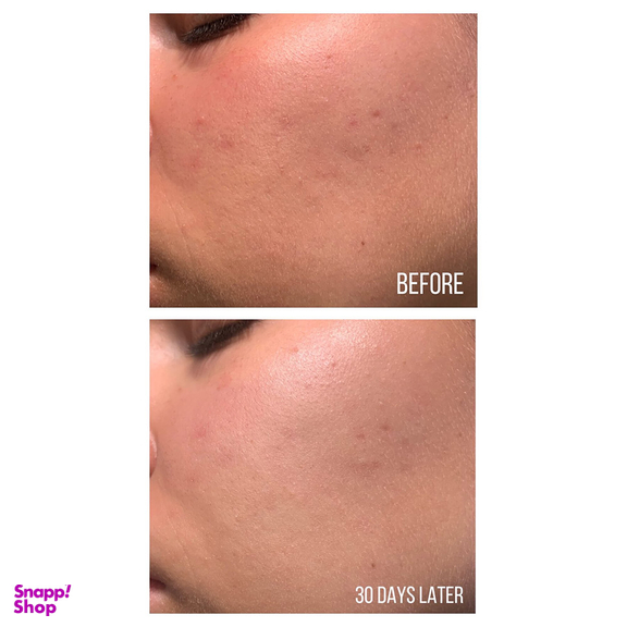 سرم ضد لک اکسیس وای مدل Dark Spot حجم 50 میلی لیتر