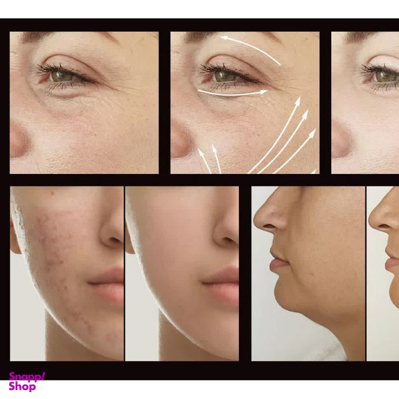 دستگاه جوانسازی هایفرکوئنسی مدل LZ-006A