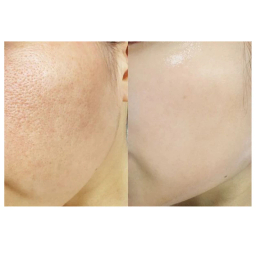 ماسک و اسکراب صورت بایوآکوا مدل هلو وزن 140 گرم