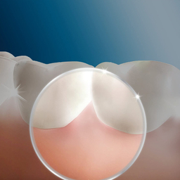 سری یدک مسواک برقی اورال بی مدل Oxyjet بسته 4 عددی