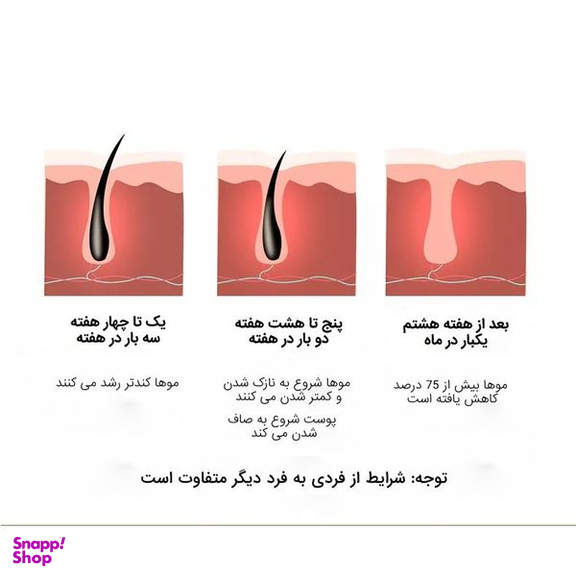 لیزر موهای زائد مدل IPL