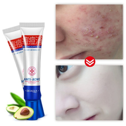 کرم ضد جوش بایو آکوا مدل ACNE ELIMINATION وزن 30 گرم