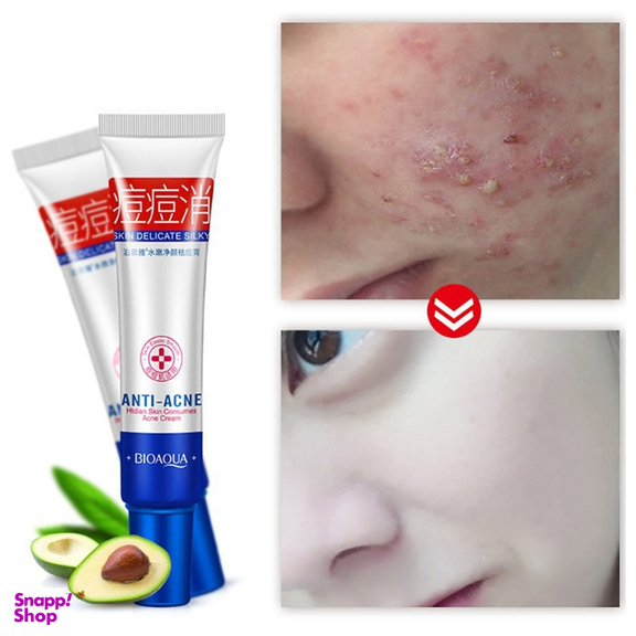 کرم ضد جوش بایو آکوا مدل ACNE ELIMINATION وزن 30 گرم
