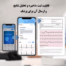 دستگاه نوار قلب و فشارسنج هوشمند ولو مدل آرمفیت پلاس