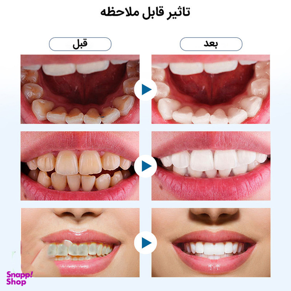 دستگاه شست و شو و جرم گیر دندان برقی مدل IPX7