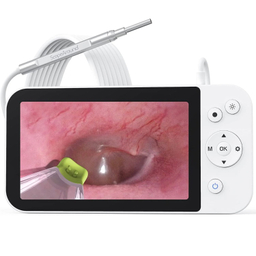 اتوسکوپ دیجیتال مدل MS500