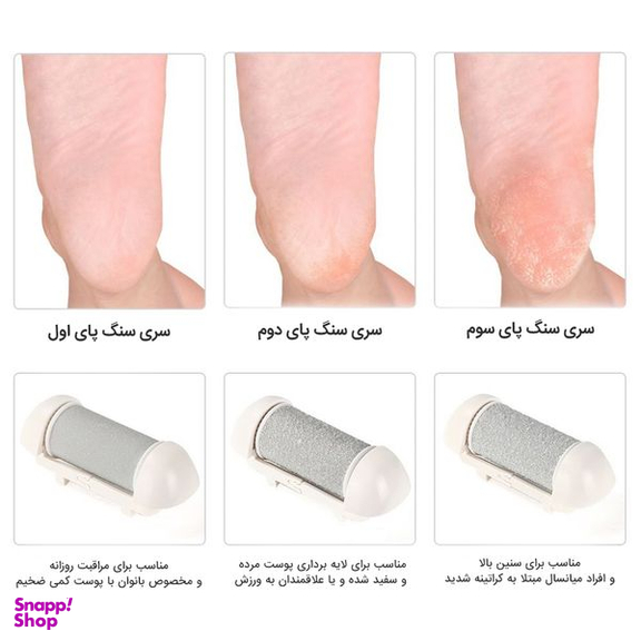 سنگ پا برقی گلویش استایل مدل ZCA001