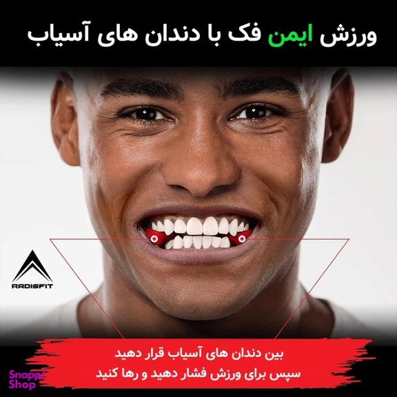 زاویه ساز فک رادیس فیت مدل Full Weight بسته 6 عددی