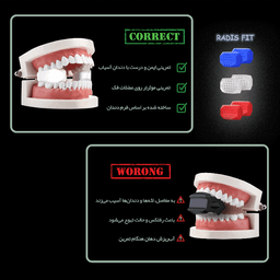 زاویه ساز فک رادیس فیت مدل Full Weight بسته 6 عددی