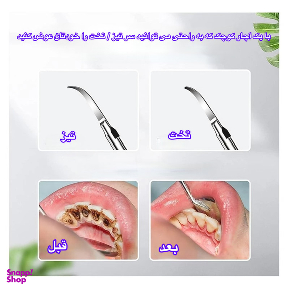 دستگاه جرمگیر دهان و دندان و مدل JYQOO2