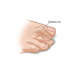 فاصله دهنده انگشت پا طب و صنعت مدل همرتو کد 10800