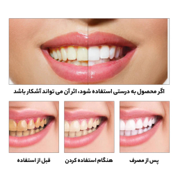 محلول سفید کننده دندان لنبنا Lanbena مدل اسنس حجم 10 میلی لیتر