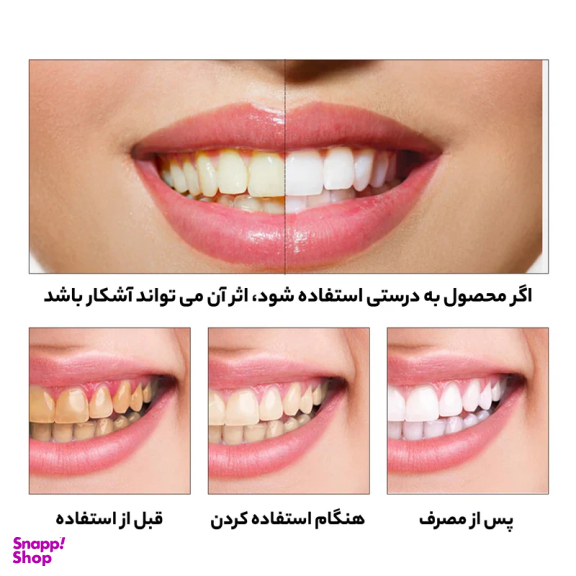 محلول سفید کننده دندان لنبنا Lanbena مدل اسنس حجم 10 میلی لیتر