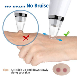 میکرودرم خانگی گلویش استایل مدل MP503