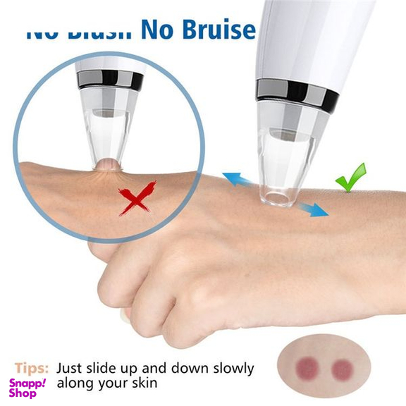 میکرودرم خانگی گلویش استایل مدل MP503