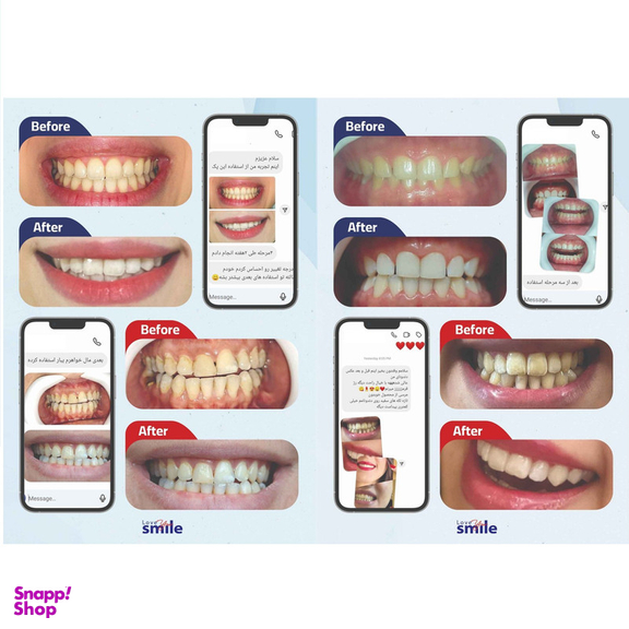 کیت بلیچینگ سفید کننده دندان خانگی دنتیلایت مدل Smile مجموعه 5 عددی