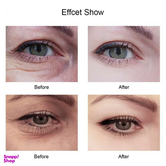 ماسک دور چشم سیازو رایوکیو مدل هیالورونیک اسید بسته 60 عددی