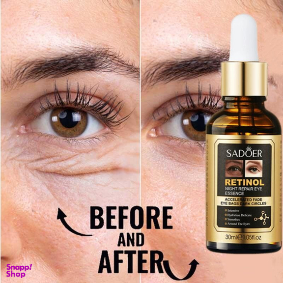 سرم ضد چروک سادور مدل رتینول حجم 30 میلی لیتر