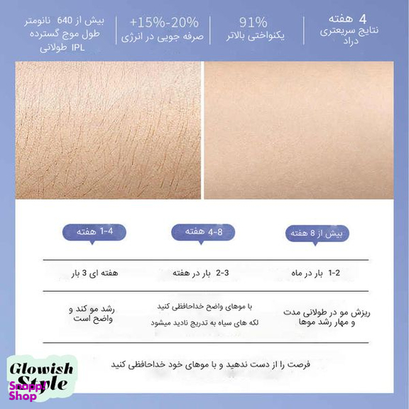 لیزر موهای زائد گلویش استایل مدل IPL-23