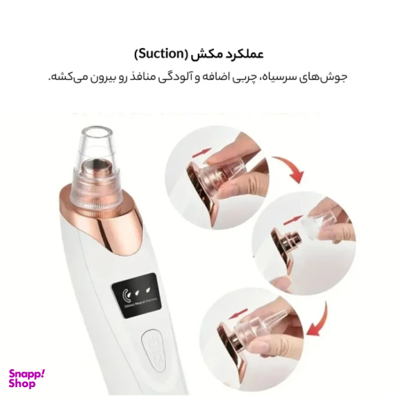 دستگاه پاکسازی و لایه بردار پوست مدل وینچر Win