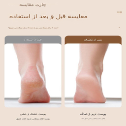 سنگ پا برقی مدل ZS-003 رنگ سفید