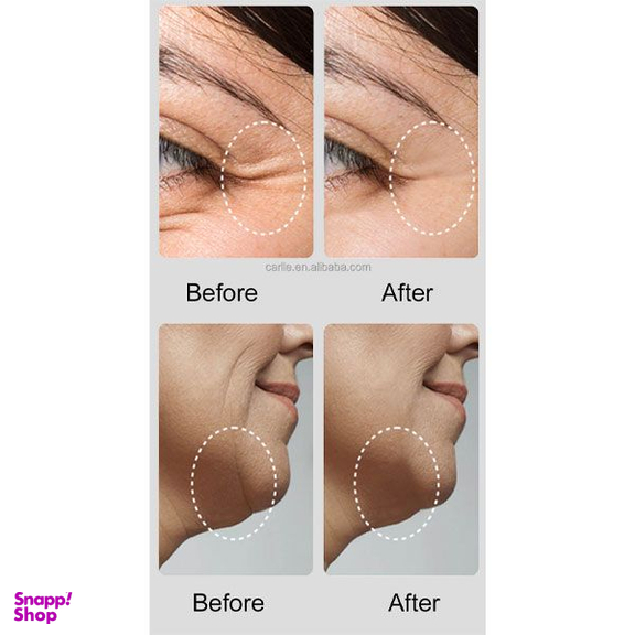 دستگاه جوانسازی و لیفت پوست مدل DR-06