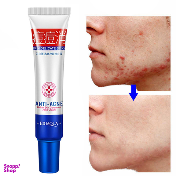 کرم ضد جوش بایو آکوا مدل ACNE ELIMINATION وزن 30 گرم
