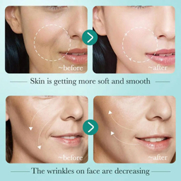 سرم پوست بایوآکوا مدل هیالورنیک اسید حجم 30 میلی لیتر