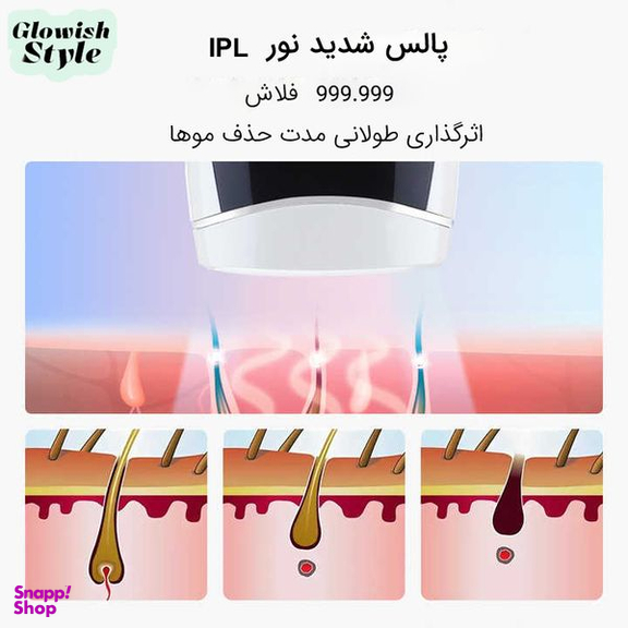 لیزر موهای زائد گلویش استایل مدل IPL-23