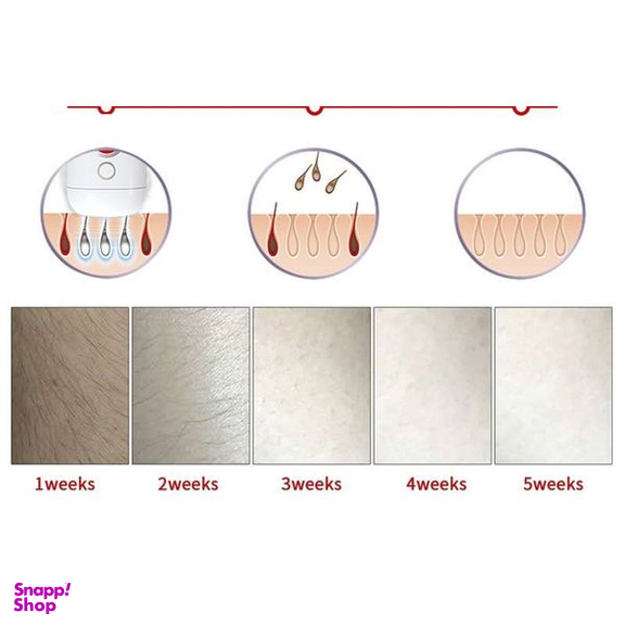 لیزر موهای زائد گلویش استایل مدل Level5