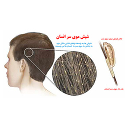 پودر شپش کش هلاک مدل Louse Killer وزن 100 گرم
