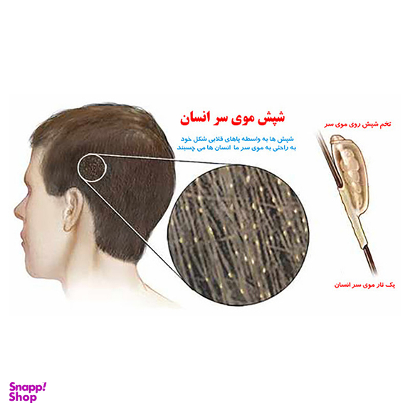 پودر شپش کش هلاک مدل Louse Killer وزن 100 گرم