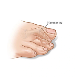 فاصله دهنده انگشت پا طب و صنعت کد 10800