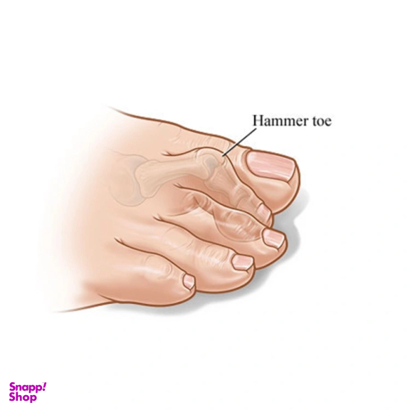 فاصله دهنده انگشت پا طب و صنعت کد 10800