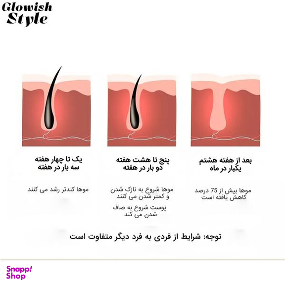 لیزر موهای زائد گلویش استایل مدل Level5