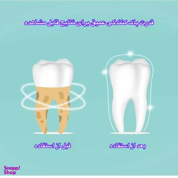 دستگاه جرمگیر دهان و دندان و مدل JYQOO2